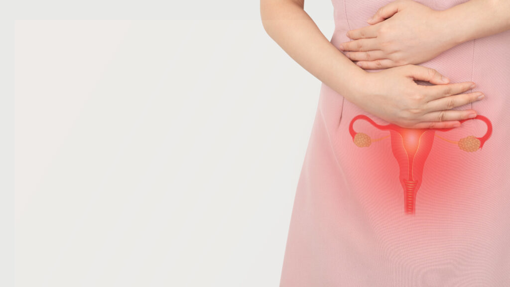 Saiba mais sobre a endometriose, doença com sintomatologia de diferentes graus